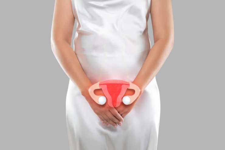 UTERINE FIBROIDS